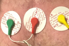 Holter Καρδιολόγος Παναγιωτόπουλος