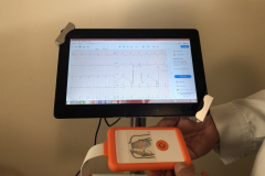 electrocardiogram