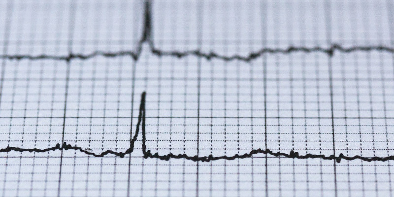 Cardiogram Electrocardiogram
