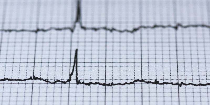 Cardiogram Electrocardiogram