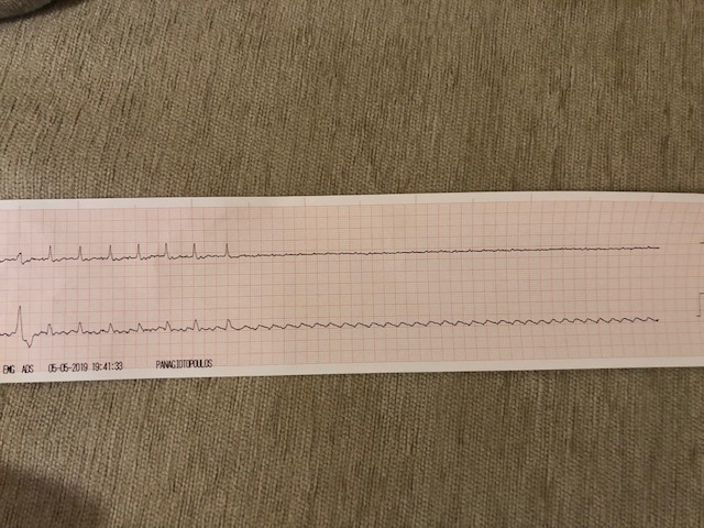 heart asystole. Cardiology Office Marousi